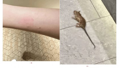 女子称入住全季酒店半夜被老鼠咬醒