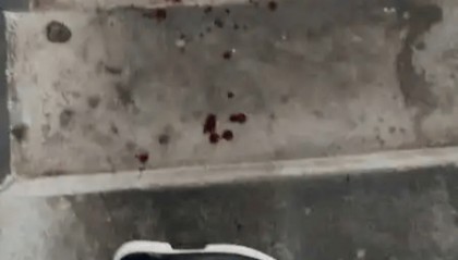 评论丨“我家狗不咬人”引发流血冲突，“犬患”背后首先是管好人